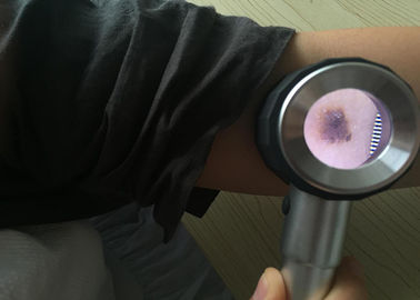 Подгонянный Отоскопе Дерматоскопе цифров здравоохранения Хандхэльд медицинский видео- для осмотра кожи