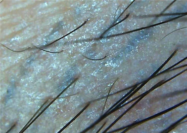 микроскоп цифров видео- Дерматоскопе кожи увеличителя 1000кс для микроскопа медицинского осмотра полного