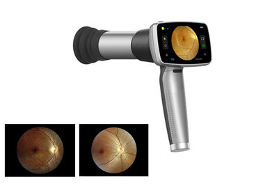 Видео- камера Fundus офтальмоскопа 45° Handheld